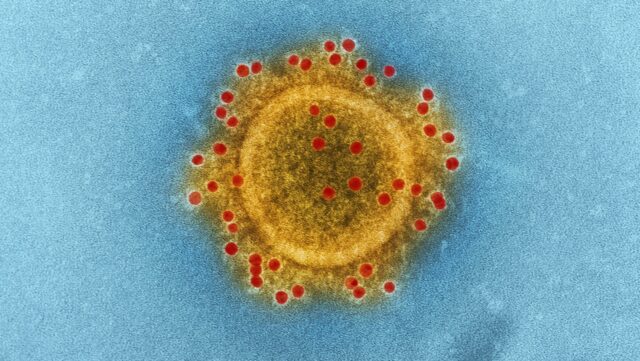 efterlysning-af-virus-forskning-|-perbraendgaard.dk